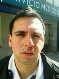 La Defensa: Patovica en Capítulo I le fracturó el maxilar a un futbolista