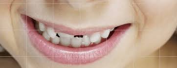 Check spelling or type a new query. Six Simple Ways To Heal Tooth Decay And Reverse Cavities