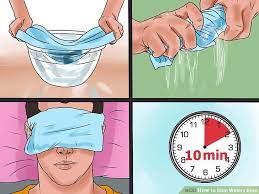 How To Stop Watery Eyes Watery Eyes Watery Eyes Remedy Eyes