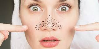 Namun dalam artikel ini, blog inkesehatan hanya akan berbagi tips menghilangkan jerawat secara alami dengan menggunakan. Cara Menghilangkan Jerawat Di Hidung Yang Bisa Anda Coba Theasianparent Indonesia