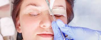 How Do You Know If You're Experiencing Posterior Capsular Haze?