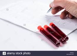 test tubes with blood on white table with test chart and