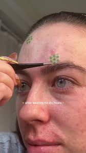 #innisfree_partner @Innisfree rescuing my skin one patch at a time ✨