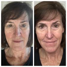 6.3.23 will forever be my favorite day. Happy 2nd anniversary to my number  1. Love you the most @christophereble ❤️