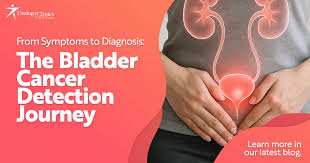 Image result for Bladder Cancer