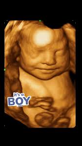 #ultrasoundhialeah #3d4dimaging #preggobelly #sonogram4d #babyboy  #7865327525