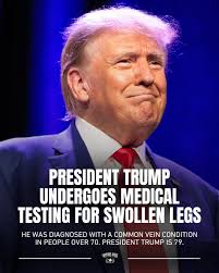 The best way to not encounter them is by keeping your home clean.