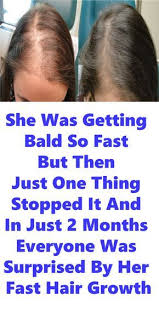 Biotin Hair Growth Serum Advanced Topical Formula To Help Grow Healthy Having Thin And Bald Hair Magical Fast Hair Growth With Only 3 Ingredients In 2020 Help Hair Grow Grow Hair Faster Hair Growth Faster