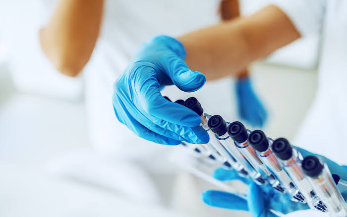 Lab vs. Instant Drug Testing