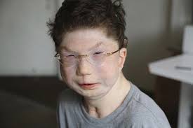 Kyle O'Reilly named 2019 Chelsea Cohen Courage Award recipient