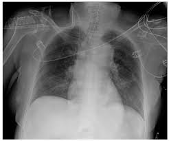 Image result for XRay Interpretation