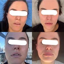 This week I have been mainly fine following the episode i had