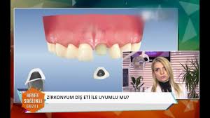 Zirkonyum diş kaplama fiyatları ve diş kaplama yöntemi hakkında detaylı bilgiyi bulabileceğiniz geniş kapsamlı bu yazımızı inceleyebilirsiniz. Zirkonyum Dis Nedir Youtube