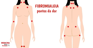 Tratamento e estilo de vida mudanças apropriadas pode ajudar a reduzir a frequência ea gravidade dos seus sintomas. Fibromialgia Doutor Sinto Dor Em Tudo Medicina Mitos E Verdades