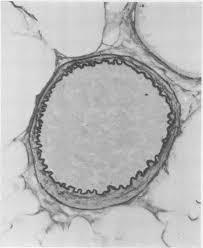 Image result for Crotalaria laburnoides