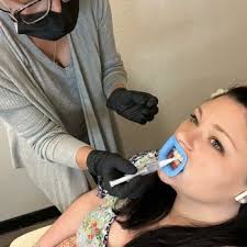 LUNA BRIGHT TEETH WHITENING