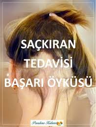 Sackiran Tedavisi Basari Oykusu Uzun Sac Sac Bakimi Sac
