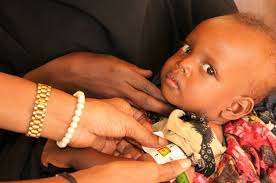Horn of Africa drought means hunger and malnutrition for people at a clinic  in Kenya