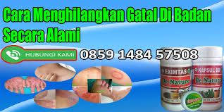 Penyebab dan cara mengatasi gatal secara alami. Cara Mengobati Gatal Di Badan Secara Alami