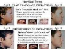 Image result for how much is orthotropic treatment