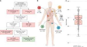 Stage 4 prostate cancer may be categorized as a local metastasis or a distant metastasis. The Genomic Landscape Of Metastatic Castration Resistant Prostate Cancers Reveals Multiple Distinct Genotypes With Potential Clinical Impact Nature Communications