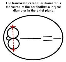 fetal biometry calculator ii