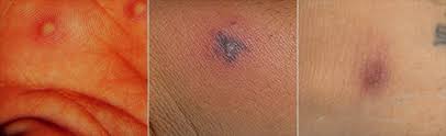 We did not find results for: General Symptoms And Causes Of Gonorrhea