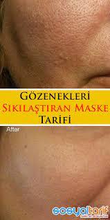 Gozenekleri Sikilastiran Maske Tarifi Homemade Skin Care Skin Care Skin