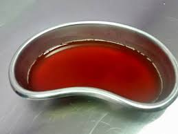 Lalu saya lihat warna airnya terlihat seperti ketika sedang menstruasi, dan saya sadari itu kencing darah, apa penyebabnya dan ke dokter mana saya harus temui? Kucing Kencing Klinik Haiwan Dan Surgeri Rizq Melaka Facebook