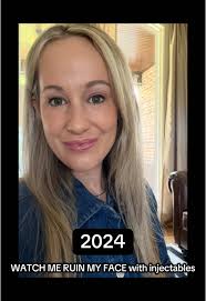 Injectables Experiment: My Aesthetic Journey