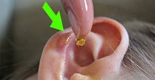 Apparently Q Tips Are Not Effective In The Case Of Earwax Build Up As They Do Not Clean The Wax Out Of The Ear Drums Theref Ear Infection Ear Wax Body Hacks