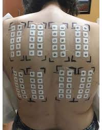 Image result for Patch Testing