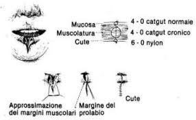 Ferite da punta e taglio. Piccola Chirurgia Pratica