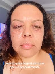 Videos De Jato Plasma