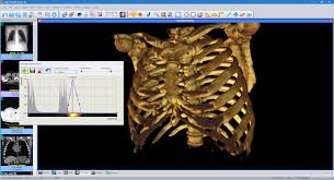 Our software can be used to convert jpeg, bmp. Sante Dicom Viewer 3d Pro Santesoft Ltd