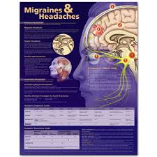 Migraines And Headaches Chart Poster Laminated