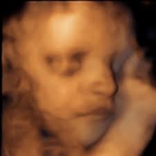 McFarlane gold label