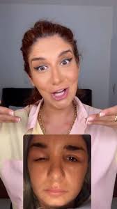 صارت معي🥹 نتبهو صبايا!!! و عطوني رائيكن بلمكياج🥰 to get this look this is  what I used primer hydro glow@kikomilanoarabia cc cream medium tan  @itcosmeticsme concealer 7.5 @charlottetilburyarabia ...