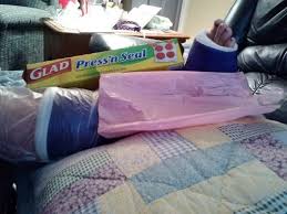 Have A Broke Bone And Want To Take A Shower Wrap The Top Of The Cast In Press And Seal Cover With Plastic Bag And Tie N Broken Ankle Broken Bone