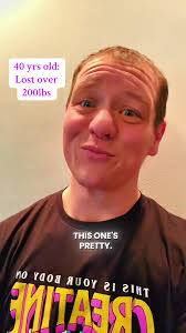 I Lost 200 Pounds without Loose Skin