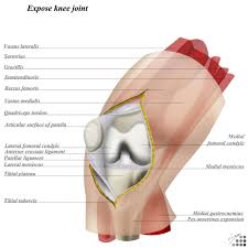 Image result for Traumatic Arthrotomy