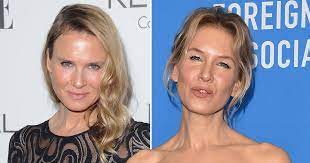 Renee zellweger's face — experts speak about plastic surgery. Renee Zellweger Talks Plastic Surgery And Beauty Standards Metro News