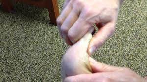 Morton neuroma foot pain pad shoe cycling mortons insole shim toolbox placement under forefoot inner tilting proper pezcycling pezcyclingnews. Hallux Rigidus Physiopedia