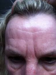 Die kunden dermaroller erfahrung mit dem modell faces of fey sind hervorragend. Wer Hat Erfahrung Mit Microneedling Und Kann Mir Ein Paar Infos Geben Leben Korper Haut