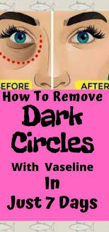 Devon Perez Pasquale (dmp1311)