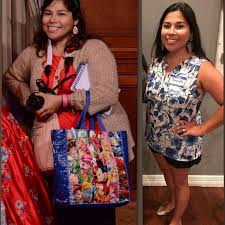 Pin On Before And After Weightloss Stories