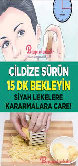 yuzdeki lekeleri geciren patates maskesi nasil yapilir dogal cilt bakimi dogal saglik dogal cilt