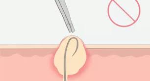 Pubic hair and underarm hair can vary in color considerably from the hair of the scalp. How To Deal With Pubic Hair 10 Steps With Pictures Wikihow