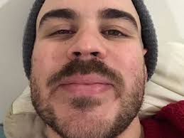 Fundraiser by Jaik Olson : puppyteeth was robbed :(