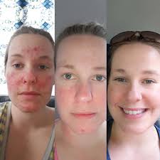 Becoming better with Arbonne